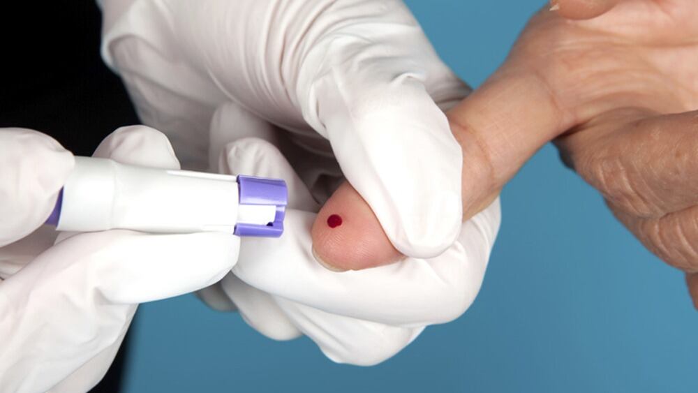 VIH y sífilis: crecen los casos en jóvenes y alertan por prácticas sexuales sin protección