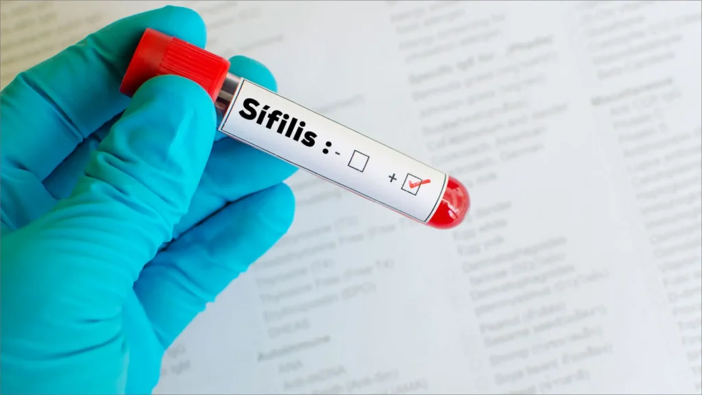 Aumentan los casos de sífilis en Salta y refuerzan las campañas de prevención
